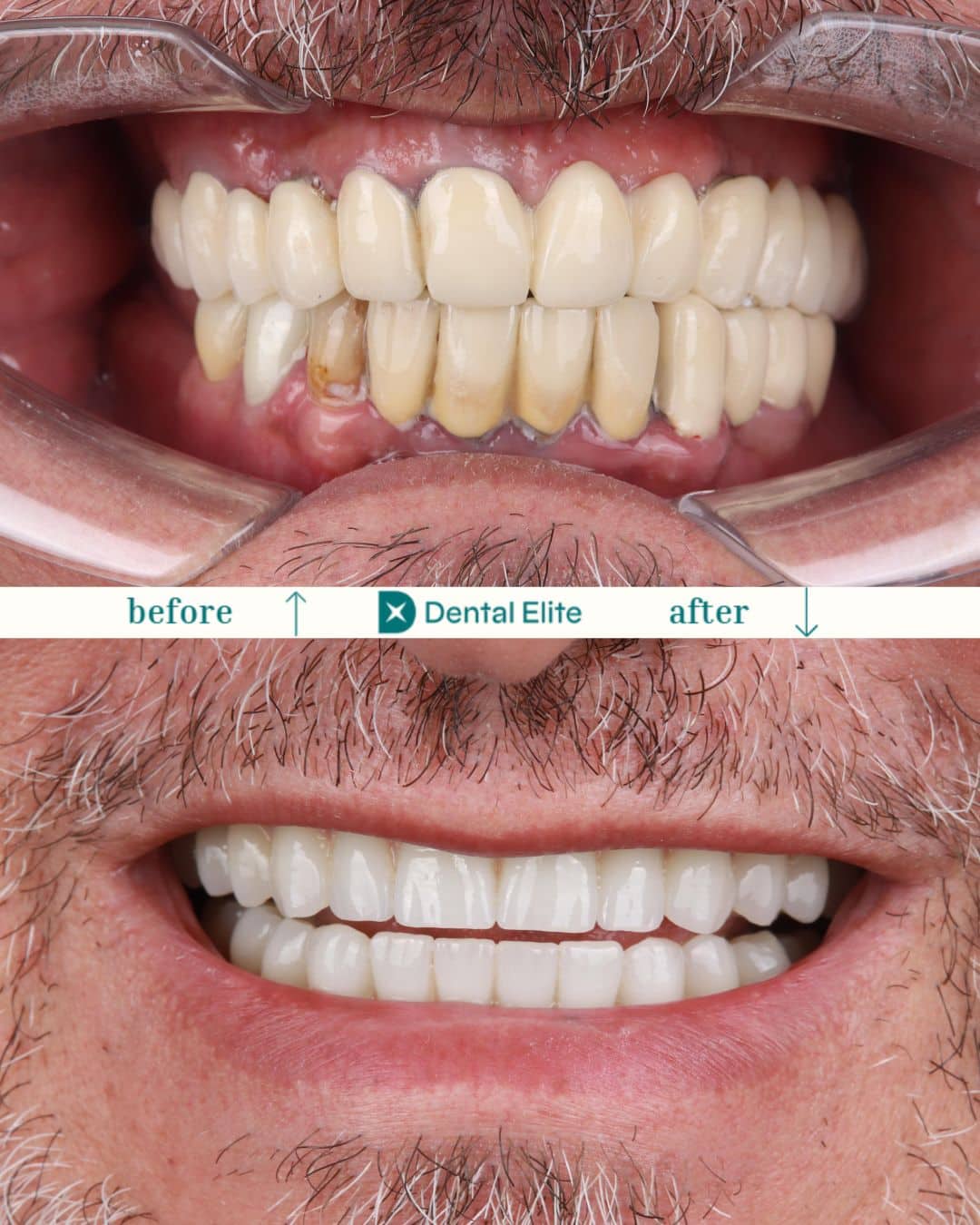Before After caz 3