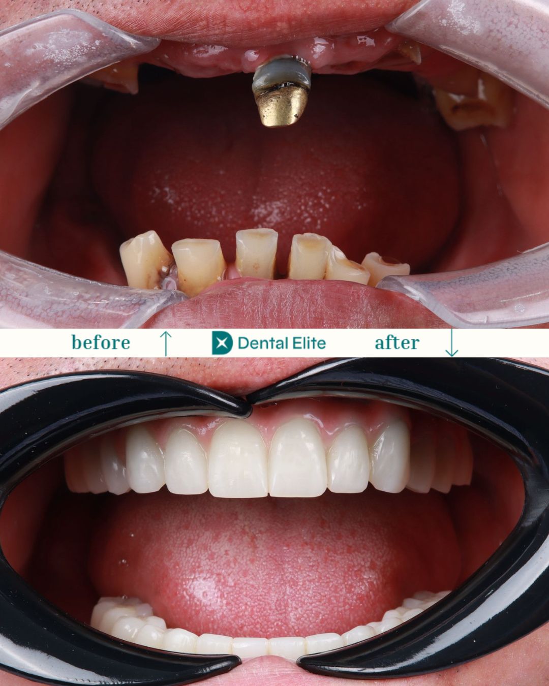 Dental Elite caz 8